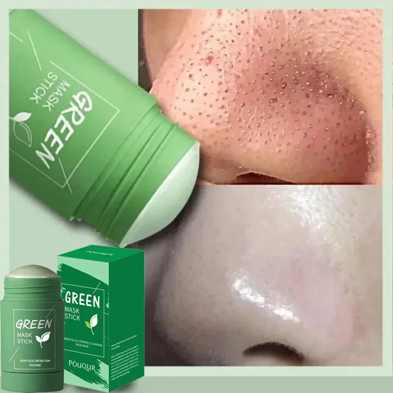 Original Green Tea Solid Mask Remove Blackhead Treat Acne Blemish White Black Dots Clean Stick Cream Pores Shrinking Skin Care