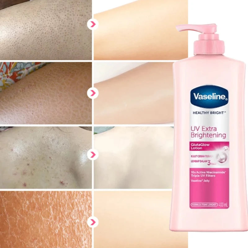 Whitening Moisturizing Chicken Skin Vaseline Body Lotion Niacinamide Whitening Moisturizing Brightening Skin Lotion 100ml/400ml