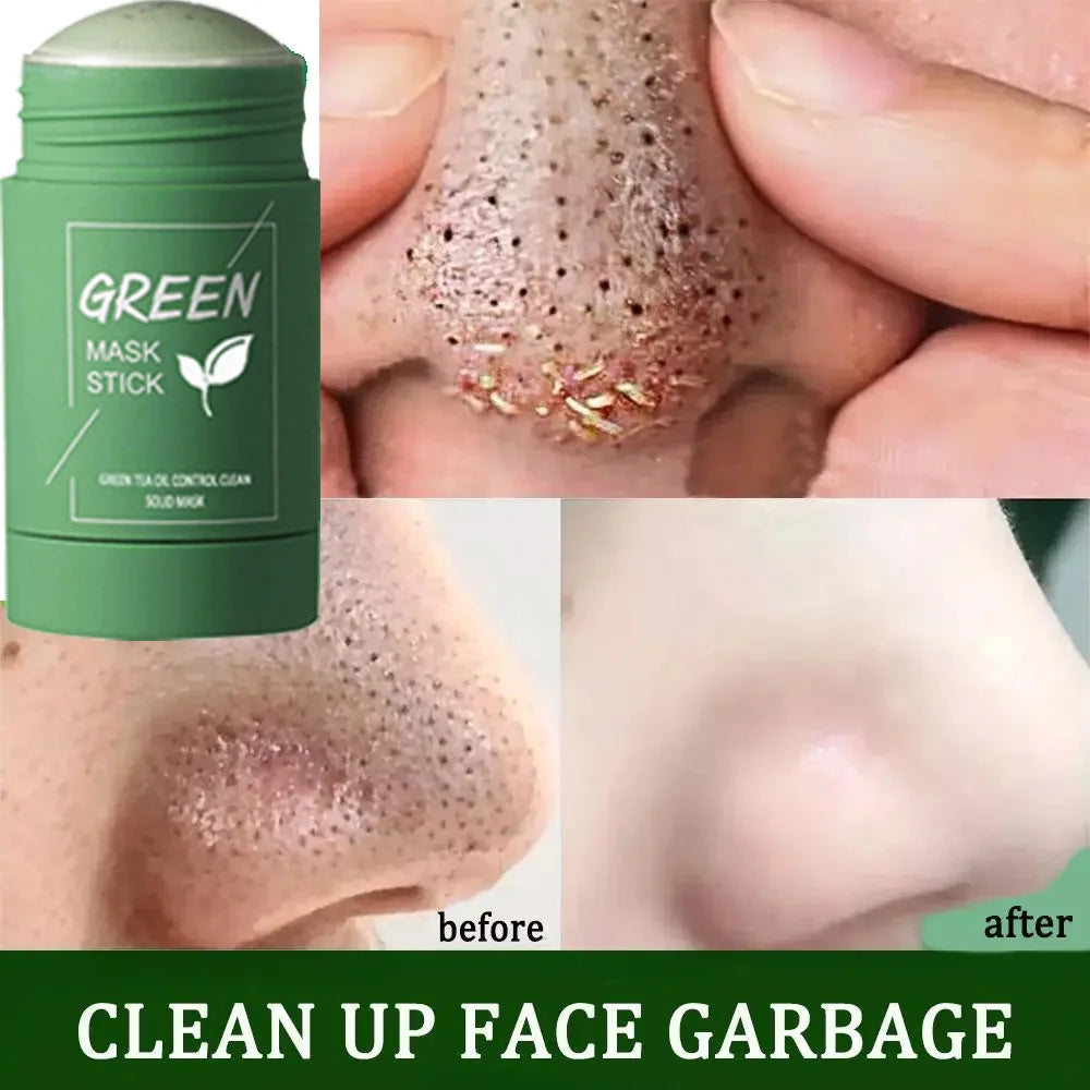Original Green Tea Solid Mask Remove Blackhead Treat Acne Blemish White Black Dots Clean Stick Cream Pores Shrinking Skin Care