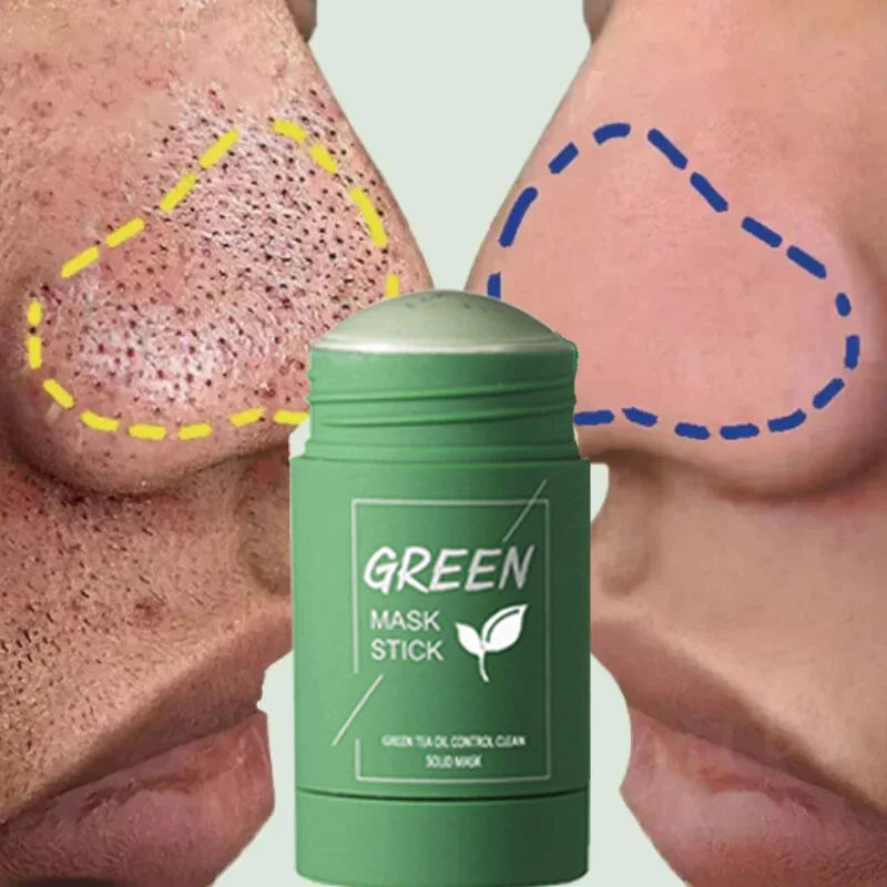 Original Green Tea Solid Mask Remove Blackhead Treat Acne Blemish White Black Dots Clean Stick Cream Pores Shrinking Skin Care