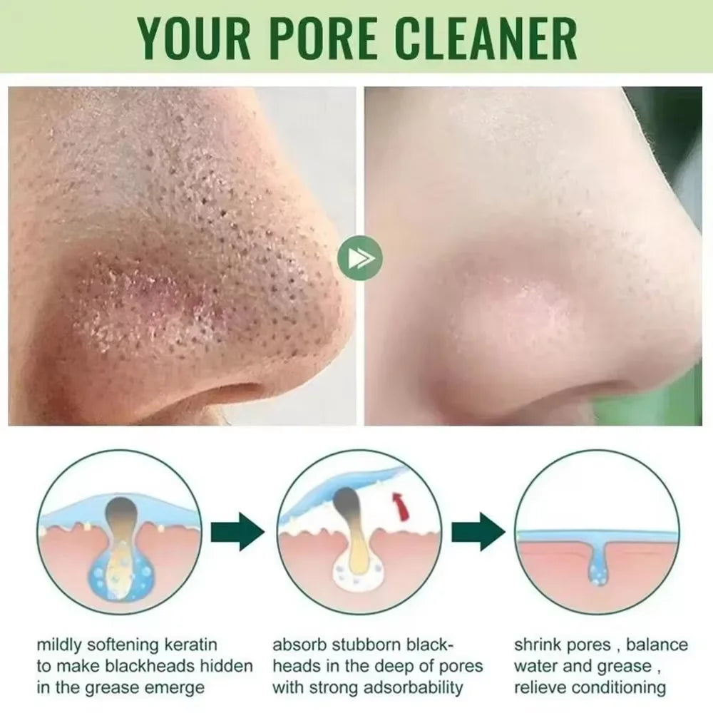 Original Green Tea Solid Mask Remove Blackhead Treat Acne Blemish White Black Dots Clean Stick Cream Pores Shrinking Skin Care